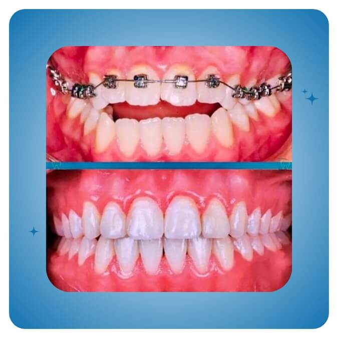 Dama Dent Clinic Dr. Dina Abdallah Case 20