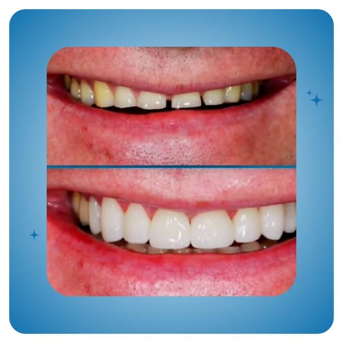 Dama Dent Clinic Dr. Dina Abdallah Case 9