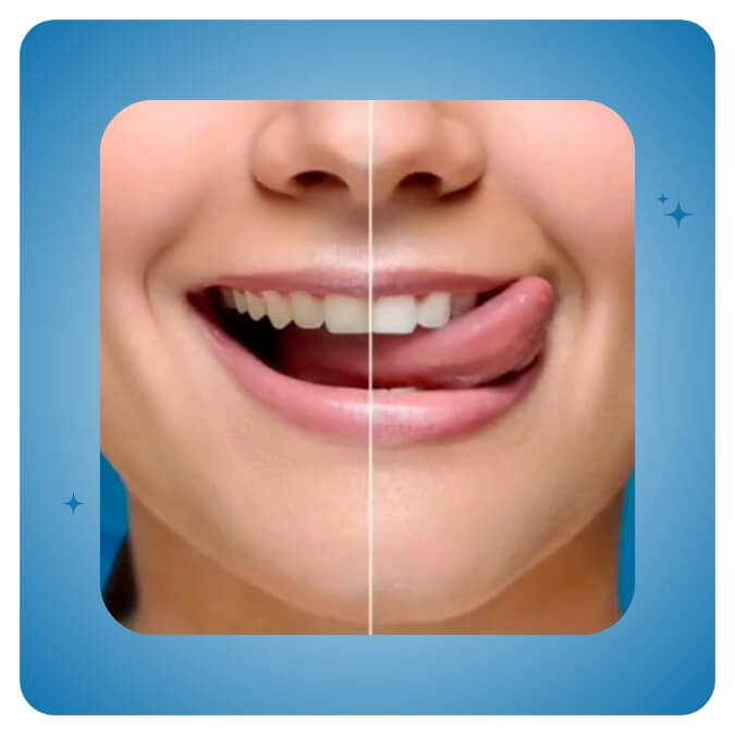 Dama Dent Clinic Dr. Dina Abdallah Case 1